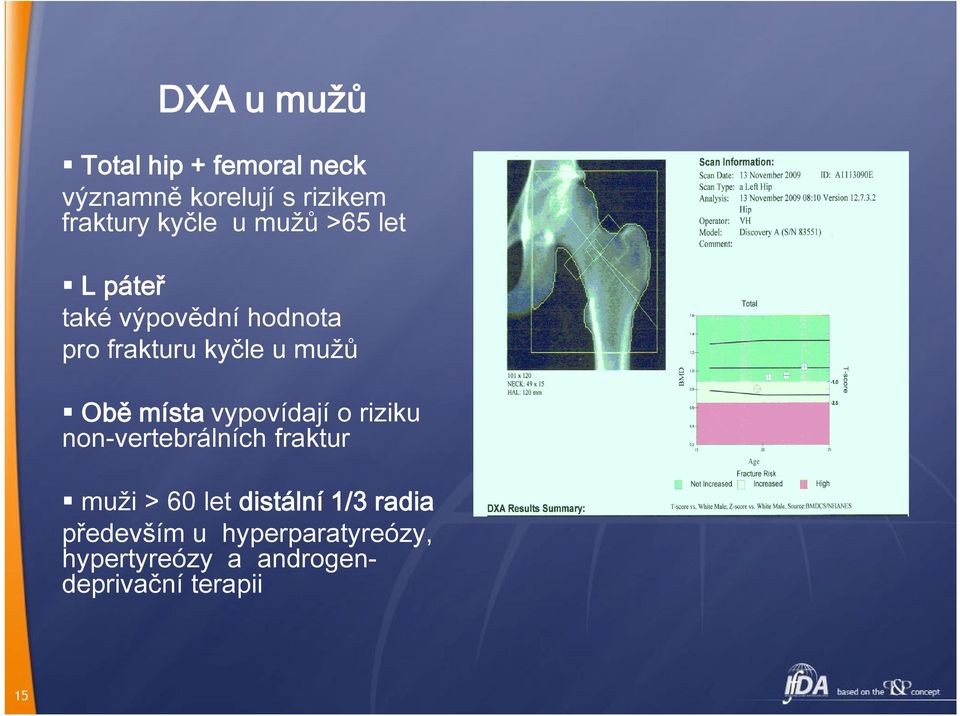 místa vypovídají o riziku non-vertebrálních fraktur muži > 60 let distální 1/3