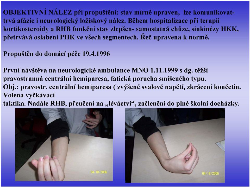 Řeč upravena k normě. Propuštěn do domácí péče 19.4.1996 První návštěva na neurologické ambulance MNO 1.11.1999 s dg.