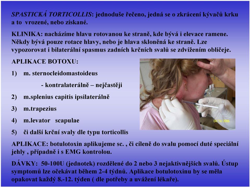 sternocleidomastoideus - kontralaterálně nejčastěji 2) m.splenius capitis ipsilaterálně 3) m.trapezius 4) m.