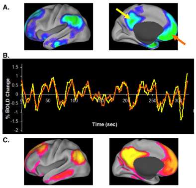 Default mode mozková síť Mozková aktivita pozorovaná za stavu pasivní visuální fixace nebo klidového stavu Low-frequency fluctuations (f do 0,1 Hz) Síť neuronů snižující svou aktivitu v průběhů