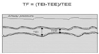 Ultrazvuk: ZOA - Lineární 2D + M mode (8-12 MHz) - 8-10 mzž střední axil čára - Frontální rovina, kolmo k hrudníku - 1-2 cm pod kostofrenickým úhlem - Sval je mezi pariet pleurou a peritoneem - V