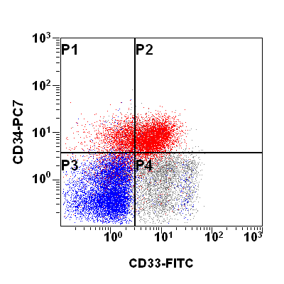 Akutní myeloidní leukémie Klonální neoplastická proliferace myeloidních blastů Antigeny prekurzorových buněk: CD34, CD38, CD117, HLA-DR,