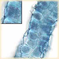 Mykorhiza Ektomykorhiza kolonizace mezibuněčných prostor kořenových pletiv (kořenová špička borovice foto M.