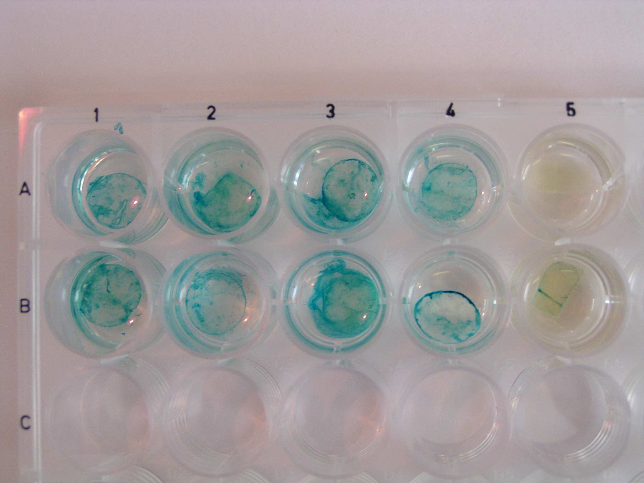 Obr. 2 Histochemický GUS test transformovaných listových disků tabáku. Pozice 1A, 1B, 2A a 2B - listové disky transformované plazmidem pwell07b.