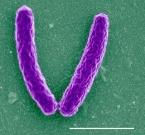 karel Kabele 223 Legionella pneumophila a TV Tyčinková bakterie, průměr 0,2 až 0,7 μm a délku 1 až 4 μ m v