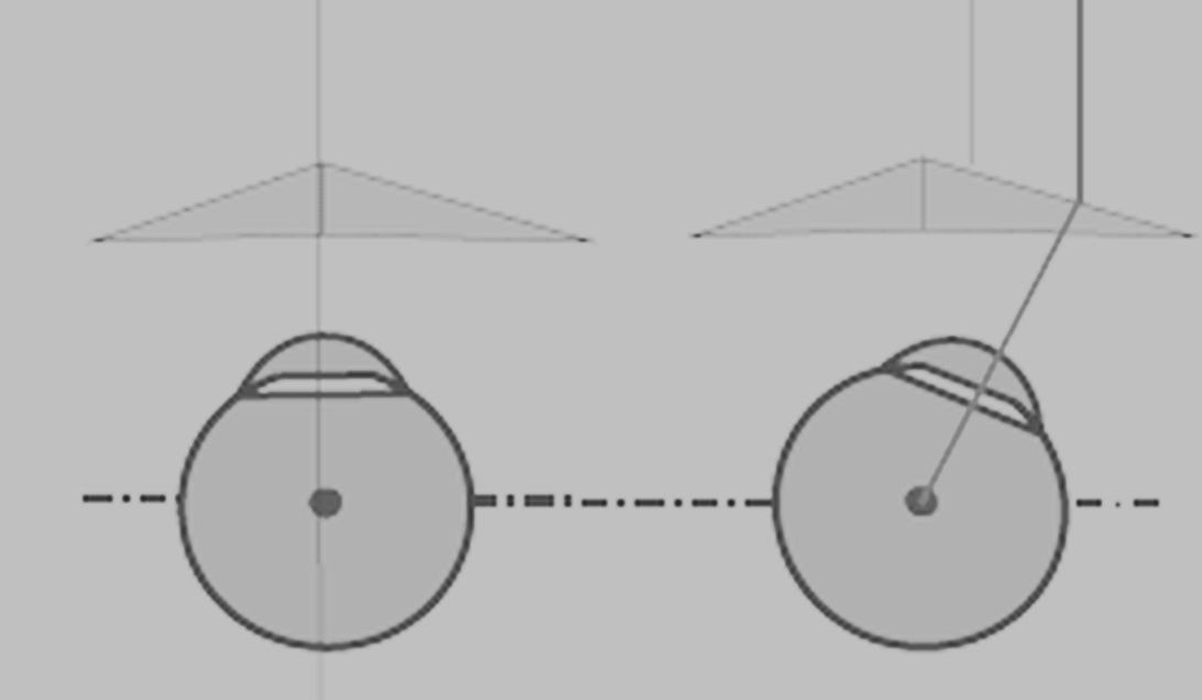 SPECIFIKA PRIZMATICKÉ KOREKCE Úprava PD (1pD = 0,25 mm)