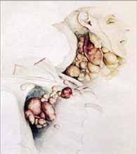Historie lymfomů Hodgkinův lymfom a potažmo i non- -Hodgkinovy lymfomy nesou svůj název po dr. Thomasu Hodgkinovi (17. 8. 1798 5. 4.