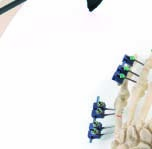 The Art of Technical Surgery UNI-FIX Svorkový modulární zevní fixátor pro fixaci všech dlouhých kostí a pánve PH-FIX Stavebnicový zevní fixátor pro fixaci všech dlouhých kostí a pánve PH-FIX XRT RTG