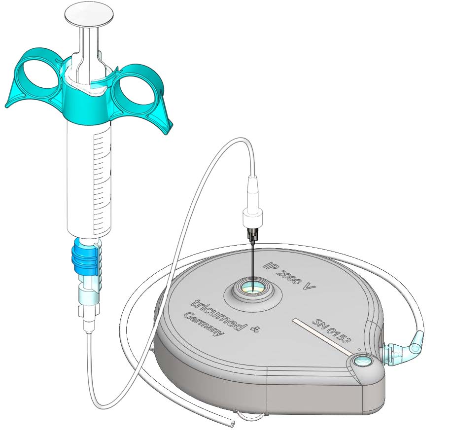 8. Před doplněním zbytku připraveného infuzního roztoku do nádržky infuzní pumpy odpojte 20ml injekční stříkačku od spojovací trubičky.