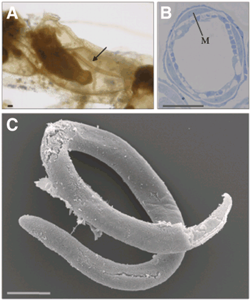 století popsán záhadný červ naplněný embryi z kolonií mechovek - až koncem 20.