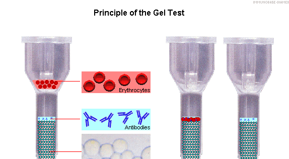 2.2. Techniky sloupcové aglutinace Techniky sloupcové aglutinace lze rozdělit na sloupcovou aglutinaci v gelu a sloupcovou aglutinaci na skleněných mikročásticích. Obrázek č.