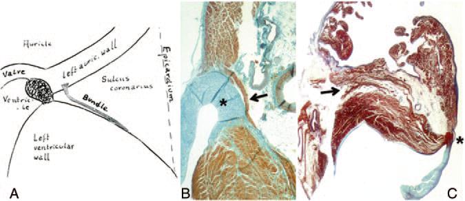 and clinical studies of excitatory spread phenomenon bearing upon the