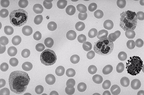 Patofyziologie krvetvorby Přednáška z patologické fyziologie pro bakaláře Složení a funkce krve objem krve - 6-8% tělesné hmotnosti - 5,5 l hematokrit - 46% muži, 41% ženy erytrocyty - 5 mil.