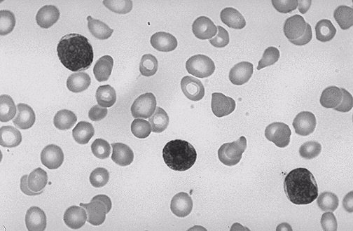 Leukocyty jaderné buňky, několik druhů krevní obraz (diferenciál l nap.