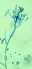 Obr. 4 Aspergillus niger, (převzato z http://www.doctorfungus.org/imageban/images/dsutton_05feb/a_niger_1.