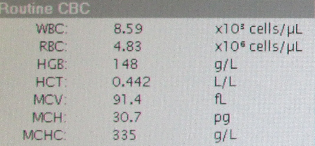 Příloha D Parametry červeného krevního obrazu měřené na analyzátoru Advia 120 Obr.