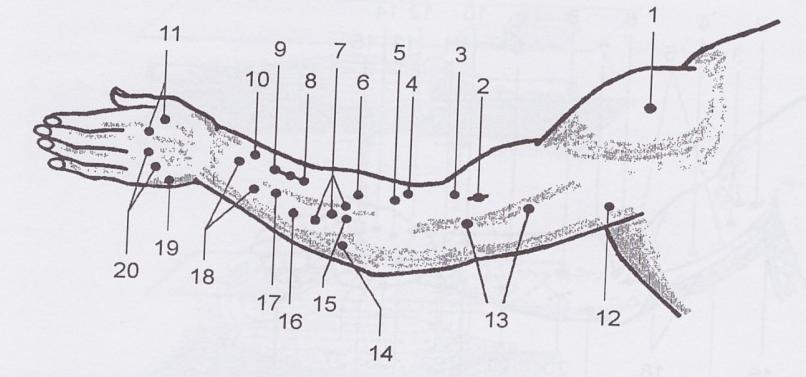 PŘÍLOHY Příloha č. 1: Motorické body na horní končetině (volární strana) (Capko, 1998, s. 195) 1 m. deltoidem; 2 n. musculocutaneus; 3 m. biceps brachii; 4 m. brachialis; 5 n. medianus; 6 m.