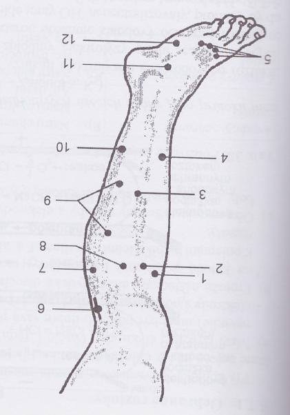 Příloha č. 5: Motorické body na bérci (Capko, 1998, s. 199) 1 m. tibialis anterior; 2 m. extensor digitorum longus; 3 m. peroneus brevis; 4 m. extensor hallucis longus; 5 mm.