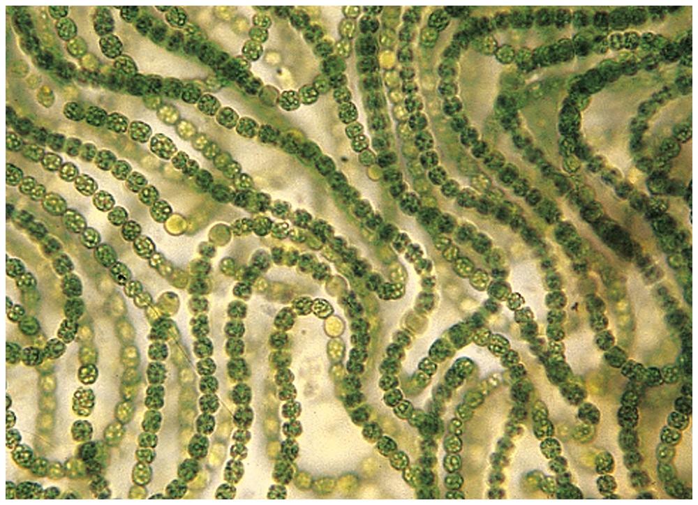 Fotosyntetizující cyanobakterie Anabaena Fotosyntetizující cyanobakterie Anabaena