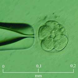 11. Vývojová řada embryí 25/ Zralý oocyt Zralé, oplození schopné vajíčko, které bylo zbaveno buněk.
