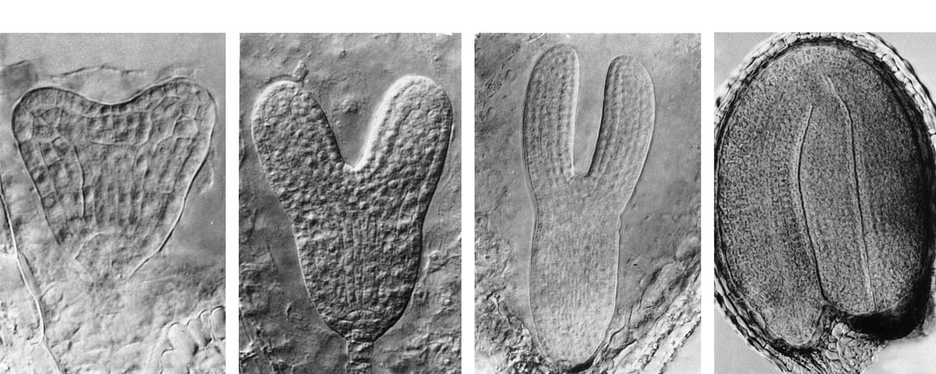 KFZR 6 Embryo Arabidopsis prochází ve svém vývoji 4 stádii Globulární stádium 1 buňka 2 buňky Meristém protoderm 8 buněk = oktant