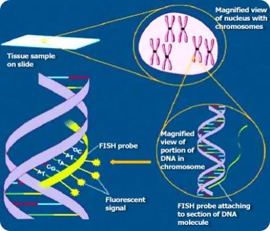 In vitro hybridizace Metoda FISH Chromozomy V jádře Testovaný