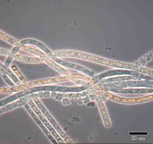 Druhou skupinou bezbarvých sirných bakterií jsou VLÁKNITÉ SIRNÉ BAKTERIE, vyskytující se v místech přísunu H 2 S i O 2, tvoří nápadné VLÁKNITÉ POVLAKY na dně stojatých vod.