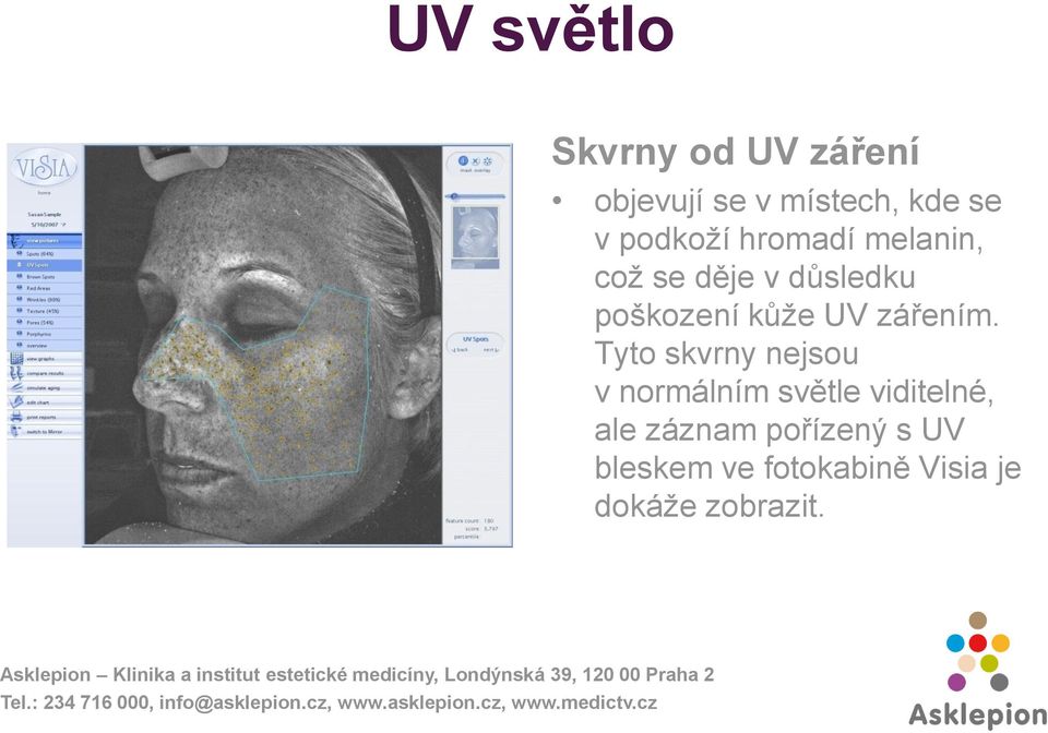 UV zářením.