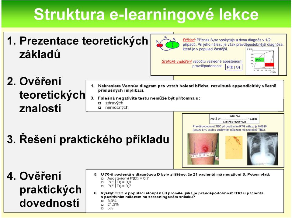 Při jeho nálezu je však pravděpodobnější diagnóza, která je v populaci častější.