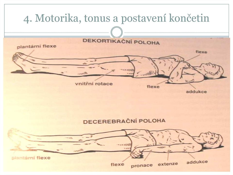 tonus a