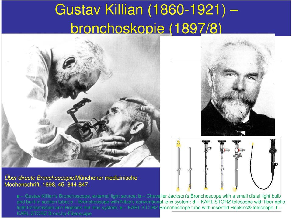 a Gustav Killian s Bronchoscope, external light source; b Chevalier Jackson s Bronchoscope with a small distal light bulb and