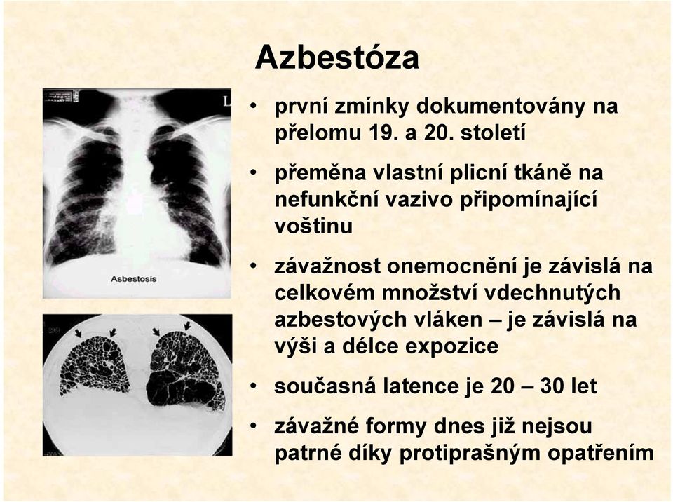 závažnost onemocnění je závislá na celkovém množství vdechnutých azbestových vláken je