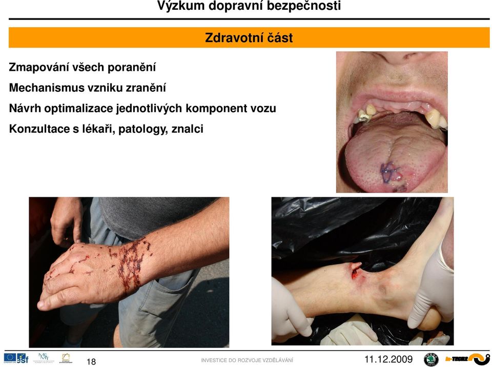 optimalizace jednotlivých komponent