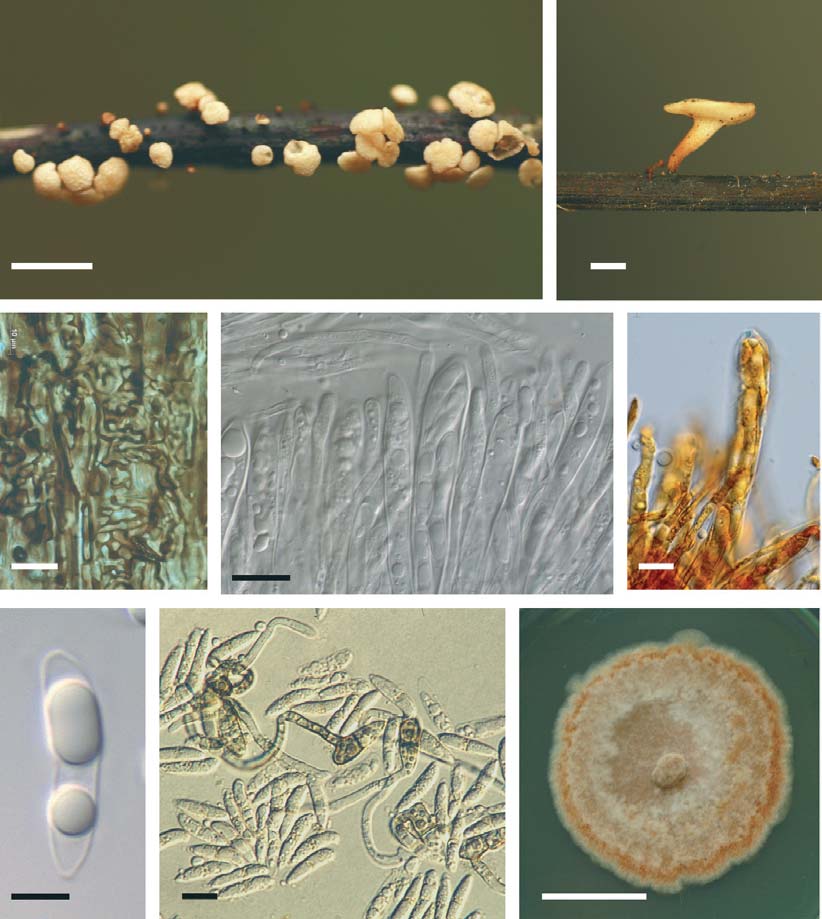 Chalara fraxinea Kowalski = anam. Hymenoscyphus albidus (Roberge ex Desm.) W. Phillips T. Kowalski and O.