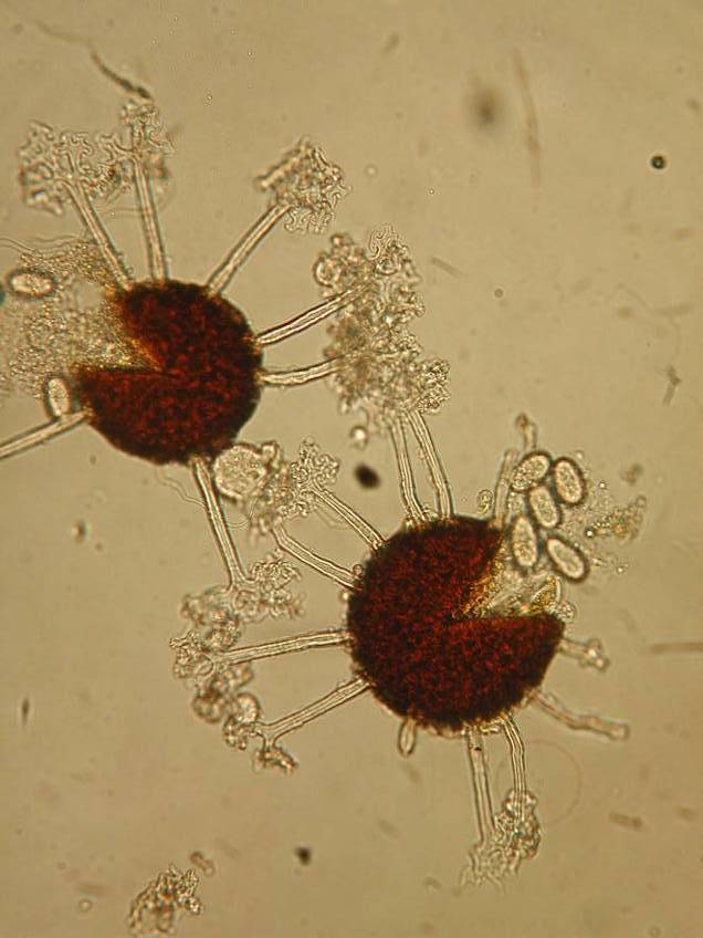 Microsphaera