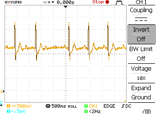 Obrázek 72: Kalibrace přístroje. Na obrázku 73 je uveden EKG signál sejmutý z pacienta bez jakéhokoliv srdečního onemocnění.