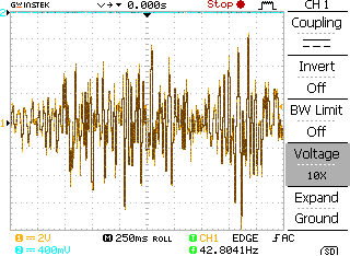 Obrázek 75: Morfologické změny EKG signálu.