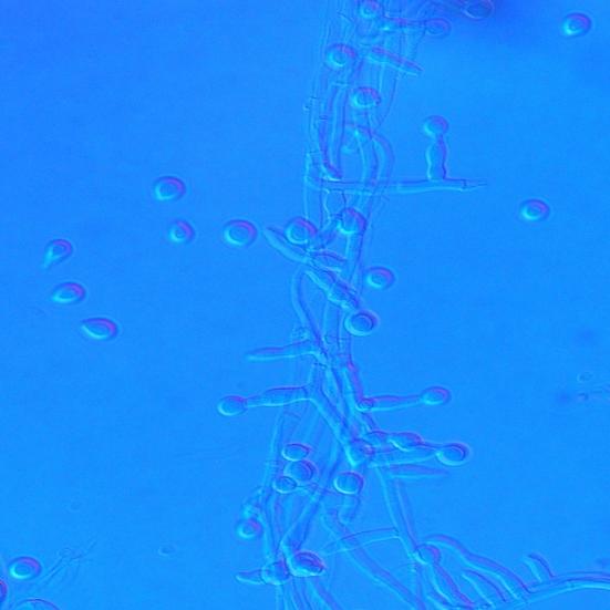 Fusarium pseudograminearum, OA, 14 dní Fusarium poae, OA, 7 dní Fusarium