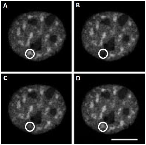 Speciální metody fluorescenční mikroskopie někdy jsou přidruženy k systému konfokálnímu - slouží zejména ke studiu dynamiky buněčných struktur - podmínkou je navození stavu, kdy je pouze určitá část