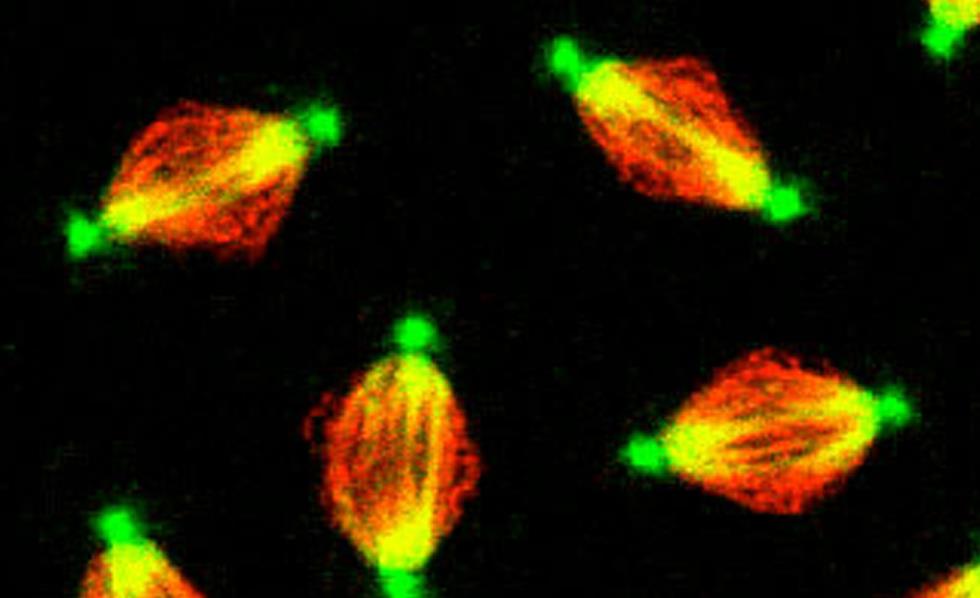 Porovnání fluorescenční (nahoře) a konfokální