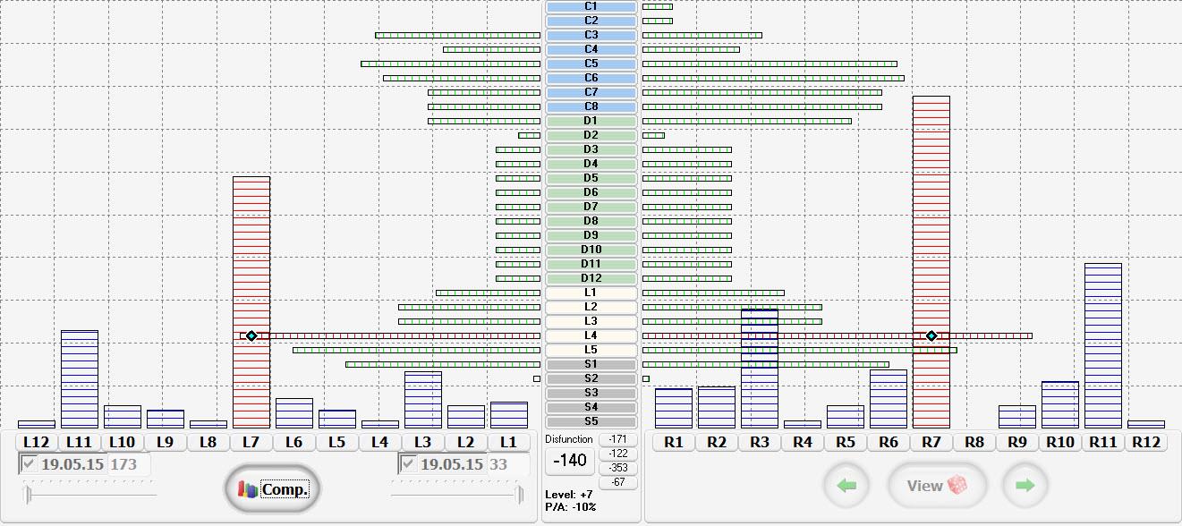 Graf 8. Graf compare pacientky T. F. 1.5. SUBJEKTIVNÍ HODNOCENÍ Pacientka po první terapii nepocítila žádné větší změny. Intenzita bolesti v bederní páteři zůstala na intenzitě 6.