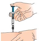 E) Aplikace injekce 1 - Vyberte si místo vpichu (viz doporučení na začátku a diagramy na konci tohoto dodatku) a zaznamenejte do záznamu o léčbě.