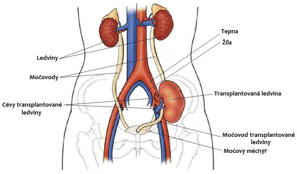 mezi odběrem štěpu a transplantací. Je pro ni typická zachovalá perfuze, sníţená funkce a zpomalená nebo chybějící exkrece.