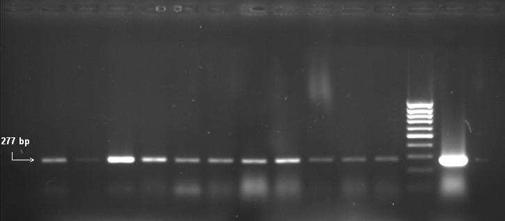 8.13 Příloha č. 13 Výsledky molekulární detekce fúzního transgenu SPI2:GFP v rostlinách lnu a vizualizace použitého standartu molekulové hmotnosti Obr.