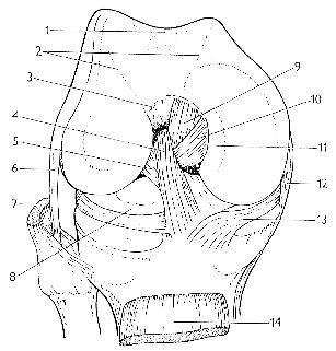 1- sulcus femoralis, 2 - linea condylopatellares, 3 - Grantův žlábek, 4 anteromediální část lig.cruciatum anterius, 5 posterolaterální část lig.cruciatum anterius, 6 lig.