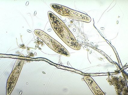 Podle trvanlivosti: Druhy preparátů dočasné nativní živý materiál Objekt: trepka