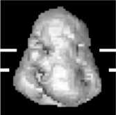 Kryoelektronová tomografie 200kDa 400 MDa Asymmetric monomeric proteins e.g.dna-pkcs, 470 kda Protein/RNA or DNA complexes e.g.ribosome, ~2 MDa Icosahedral viruses 60-fold symmetry e.g.adenovirus, ~150 MDa Detergent solubilized membrane proteins e.