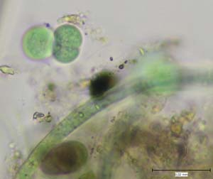 16. Chlorogloea sp. typ 1 17. Chlorogloea sp. typ 2 18. Chlorogloea sp. typ 3 19.