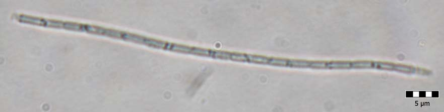 23. Leptolyngbya cf. muralis 24. Leptolynbya cf. tenuissima 25.