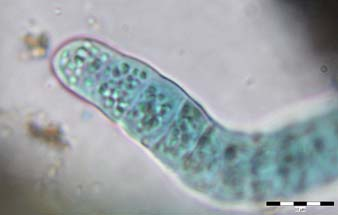 37. Scytonema cf.